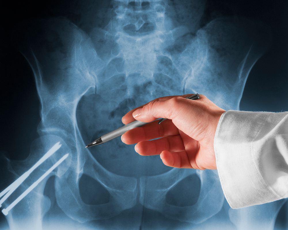 Orthopaedic Care