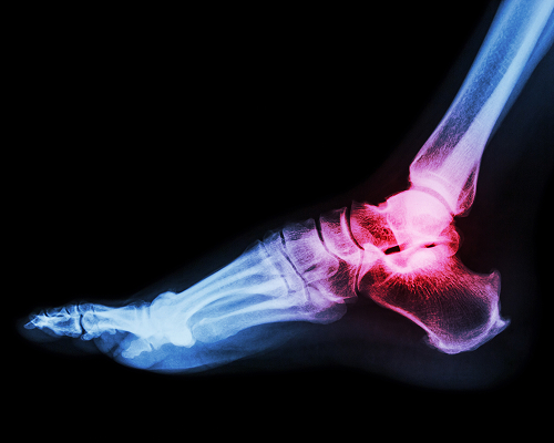 Foot & Ankle